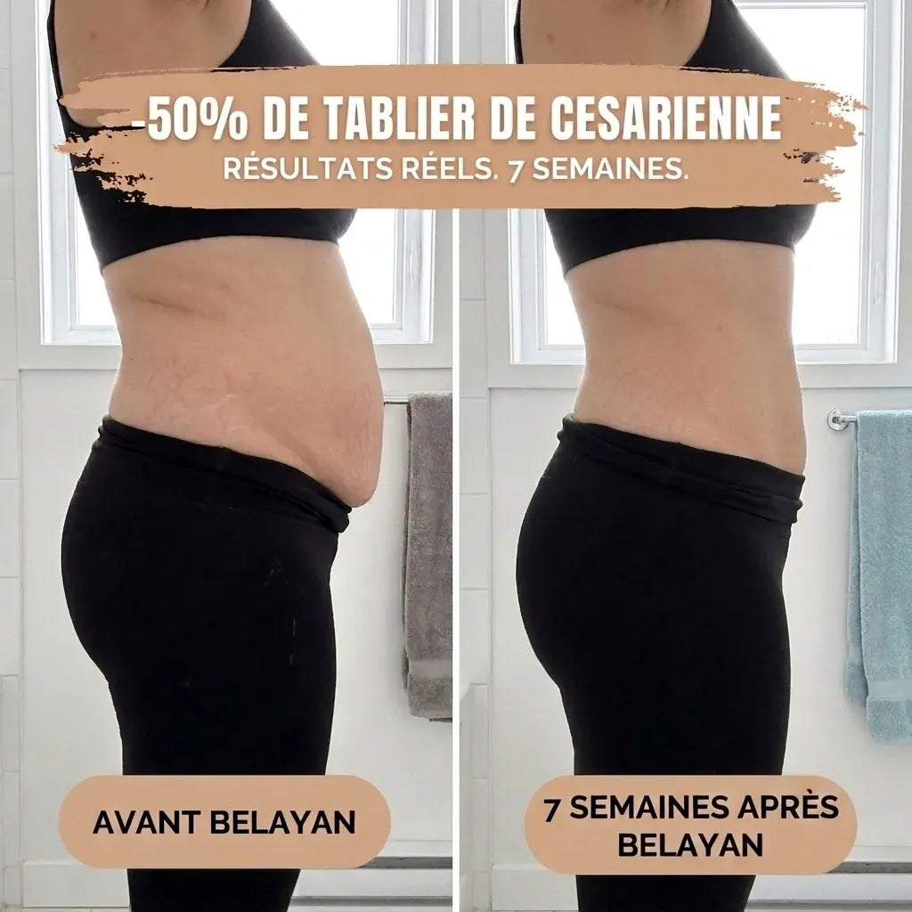 Culotte post-partum AUVA